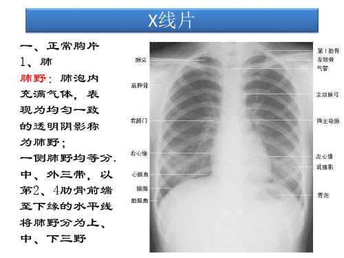 X线片