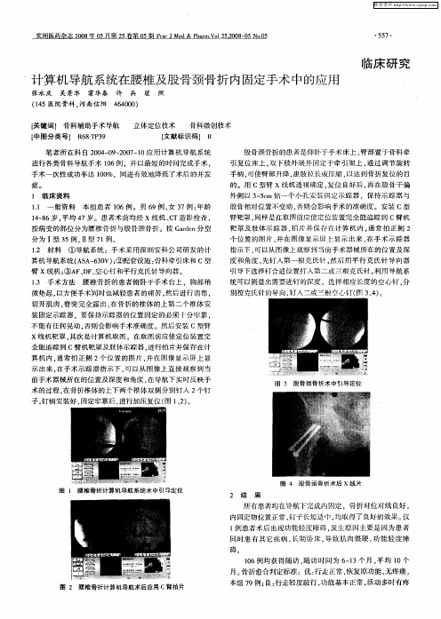 计算机导航系统在腰椎及股骨颈骨折内固定手术中的应用