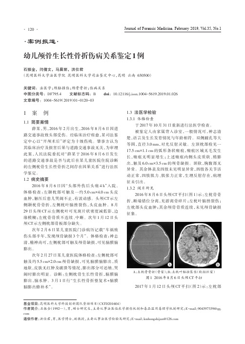 幼儿颅骨生长性骨折伤病关系鉴定1例
