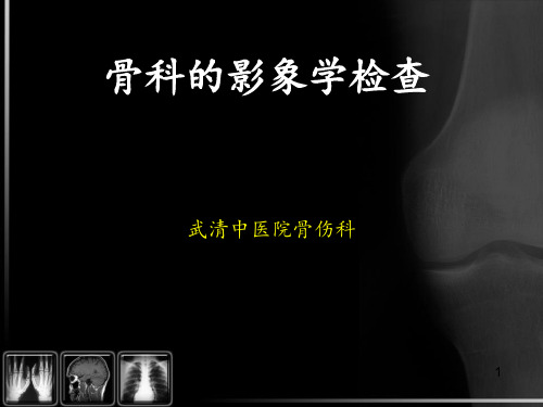 骨科的影像学检查ppt课件