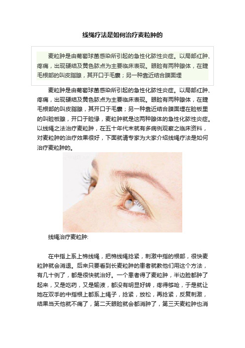 线绳疗法是如何治疗麦粒肿的