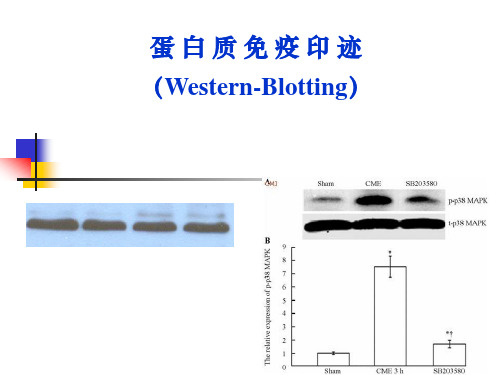 Western_blotting