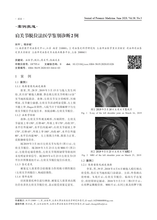 肩关节脱位法医学鉴别诊断2例