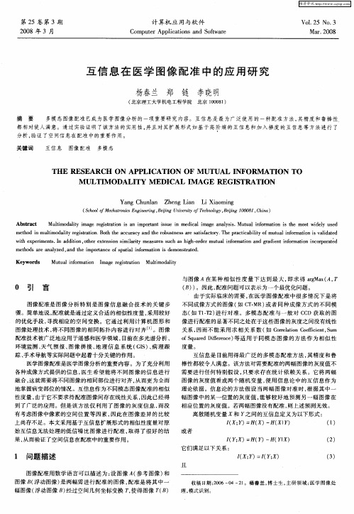 互信息在医学图像配准中的应用研究