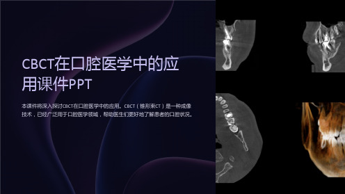 CBCT在口腔医学中的应用课件PPT