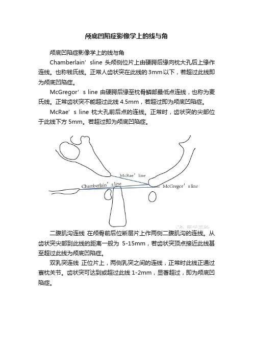 颅底凹陷症影像学上的线与角