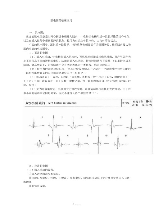 肌电图的临床应用