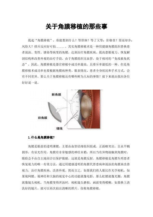 关于角膜移植的那些事