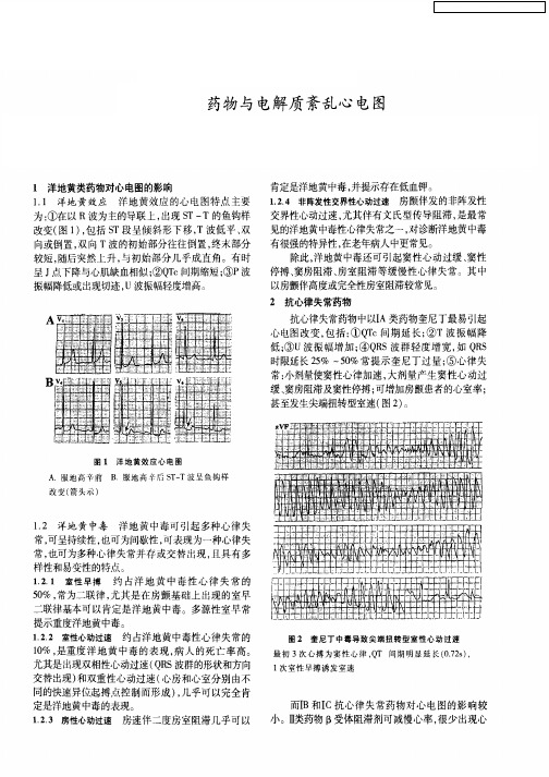 药物与电解质紊乱心电图