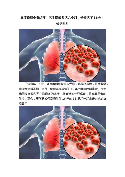 肺癌晚期全身转移，医生说最多活六个月，她却活了16年！秘诀公开