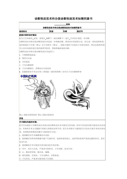 诊断性刮宫术和分段诊断性刮宫术知情同意书