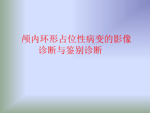 颅内环形占位性病变的影像诊断与鉴别诊断