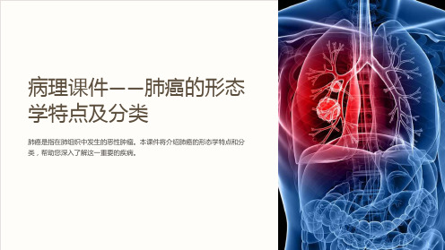 病理课件——肺癌的形态学特点及分类