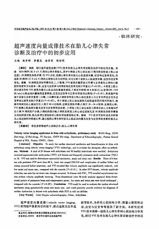 超声速度向量成像技术在胎儿心律失常诊断及治疗中的初步应用