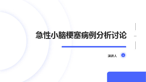 急性小脑梗塞病例分析讨论