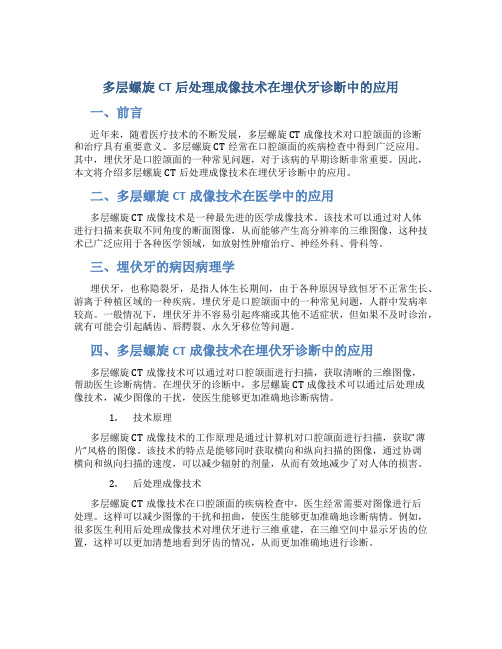 多层螺旋CT后处理成像技术在埋伏牙诊断中的应用