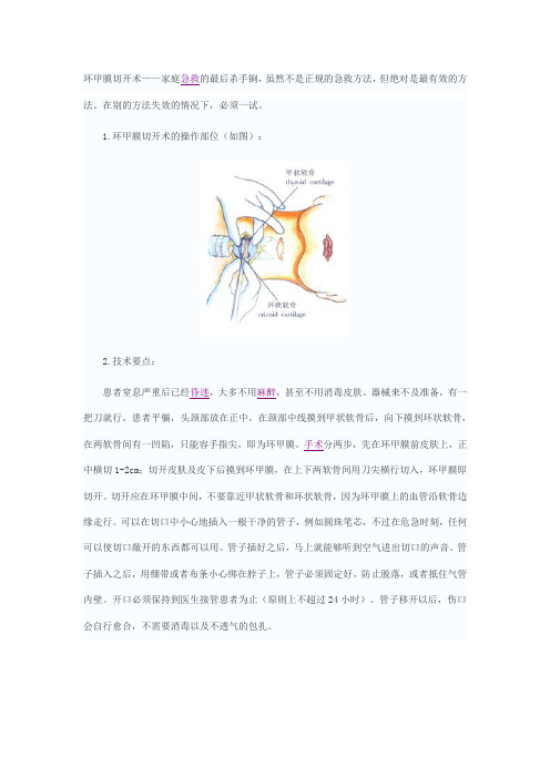 环甲膜切开术