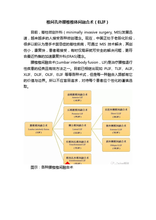 椎间孔外腰椎椎体间融合术（ELIF）