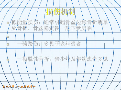 骨盆骨折的分型和治疗