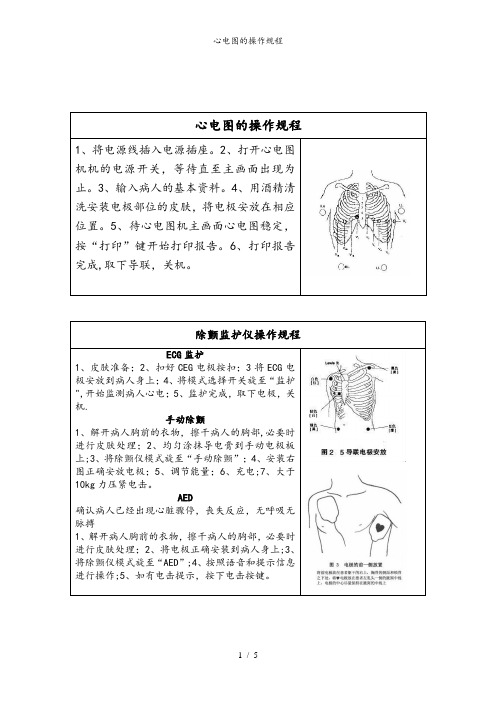 心电图的操作规程