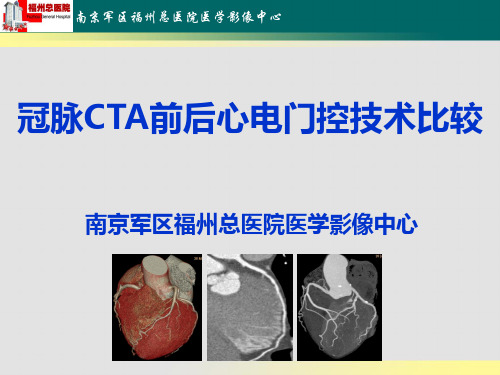 冠脉CTA前后心电门控技术比较