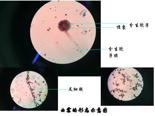 放线菌和霉菌形态的观察——显微图整理