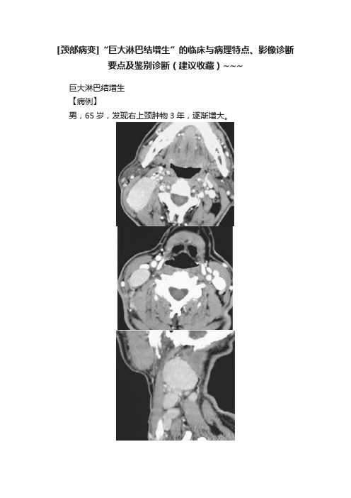 [颈部病变]“巨大淋巴结增生”的临床与病理特点、影像诊断要点及鉴别诊断（建议收藏）~~~