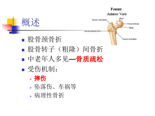 老年髋部骨折(股骨颈骨折,股骨转子间骨折课件)