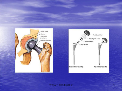 全髋关节置换术后康复课件