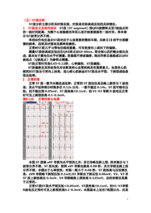 另类心电图学讲义9--ST段分析