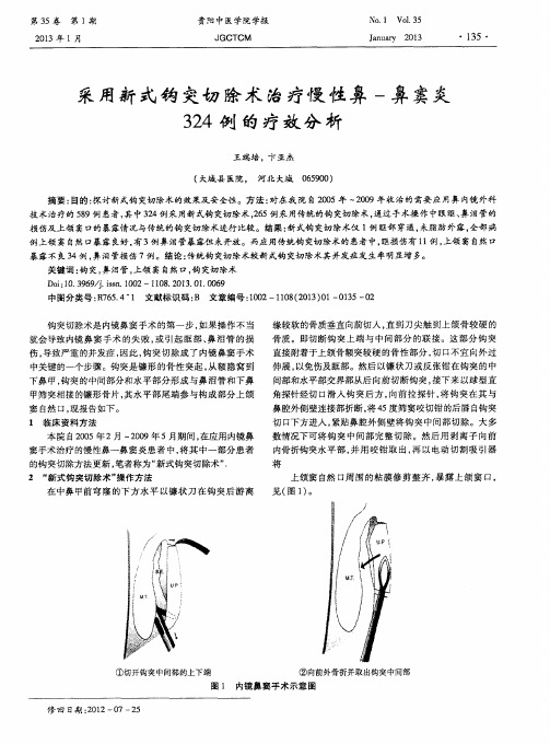 采用新式钩突切除术治疗慢性鼻-鼻窦炎324例的疗效分析