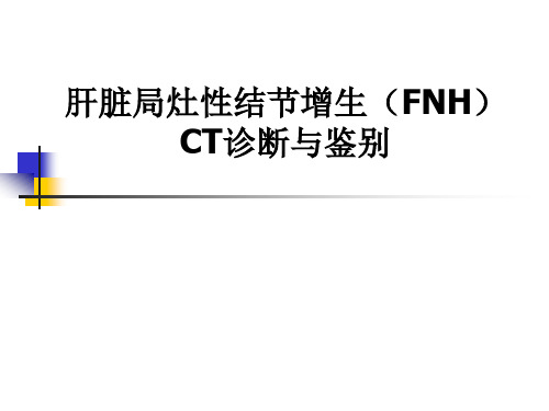 肝脏局灶性结节增生(FNH)CT诊断与鉴别