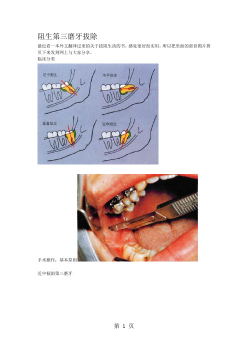 阻生牙的拔除共25页word资料