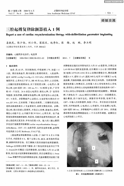 三腔起搏复律除颤器植入1例
