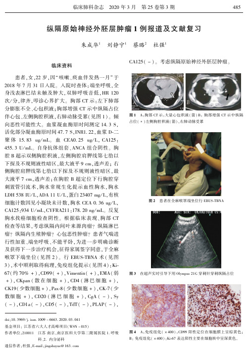 纵隔原始神经外胚层肿瘤1例报道及文献复习