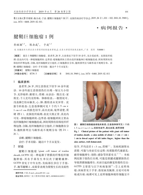 腱鞘巨细胞瘤1例
