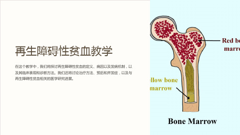 再生障碍性贫血教学