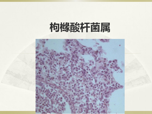 枸橼酸杆菌属