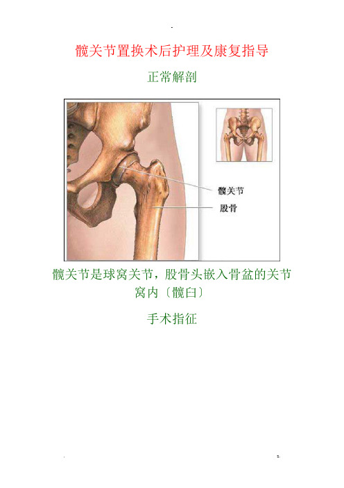 髋关节置换术后护理与康复指导