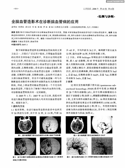 全脑血管造影术在诊断脑血管病的应用