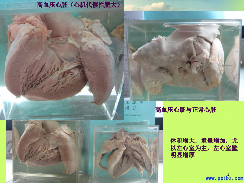 病理学大体标本ppt课件