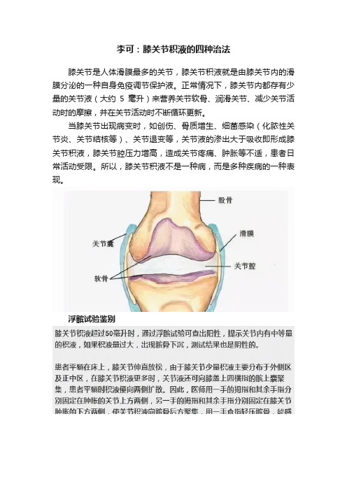 李可：膝关节积液的四种治法