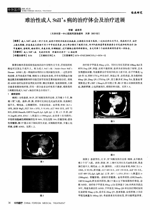 难治性成人Still's病的治疗体会及治疗进展