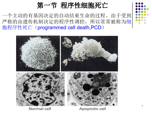 细胞程序性死亡与细胞衰老课件