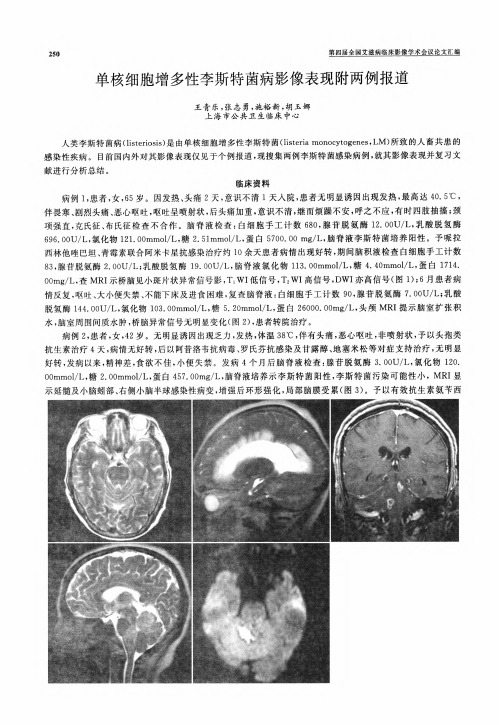 单核细胞增多性李斯特菌病影像表现附两例报道