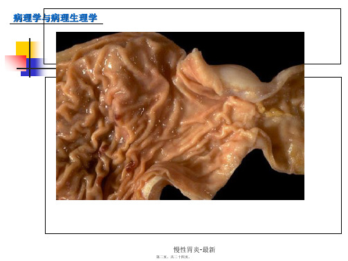 慢性胃炎最新课件