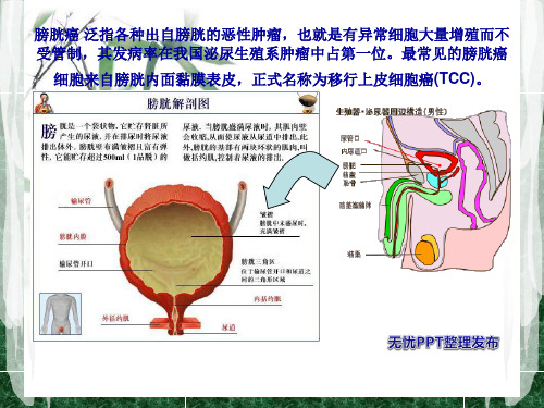 膀胱癌的护理