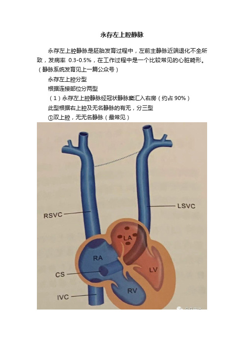 永存左上腔静脉