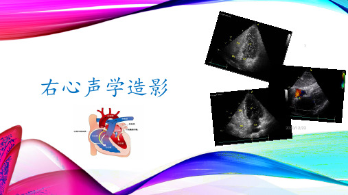 右心声学造影 ppt课件