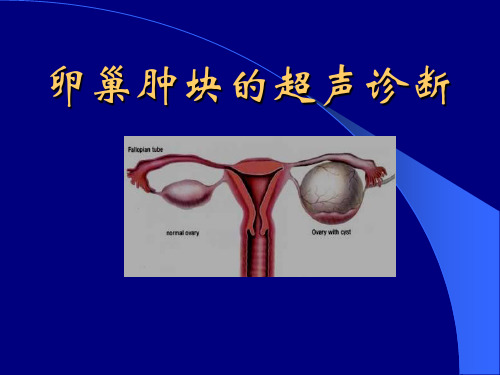 卵巢肿块的超声诊断 PPT课件